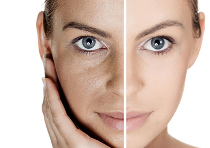 Platelet Rich Plasma Treatment: Finchley Cosmetic Salon London