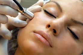 Microdermabrasion Treatment in London