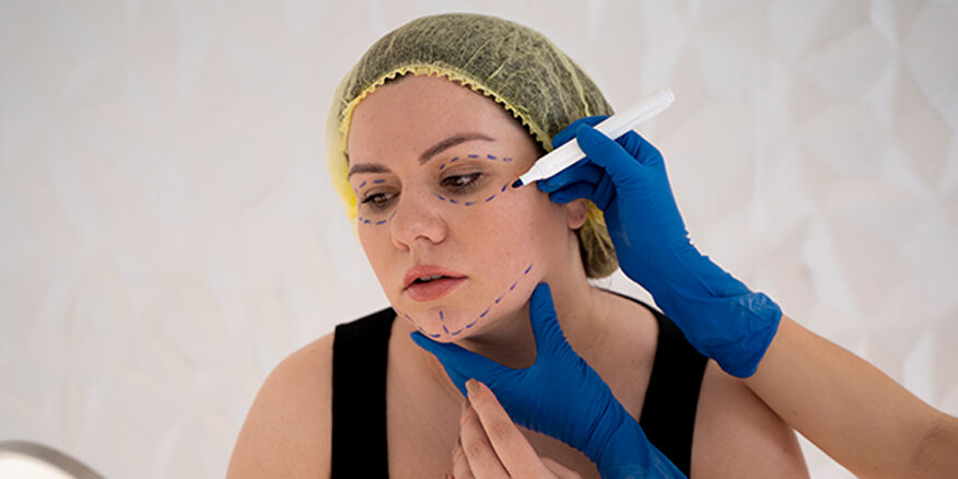 Thread Vein Treatment in London, North London