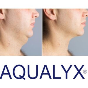 Aqualyx treatment,