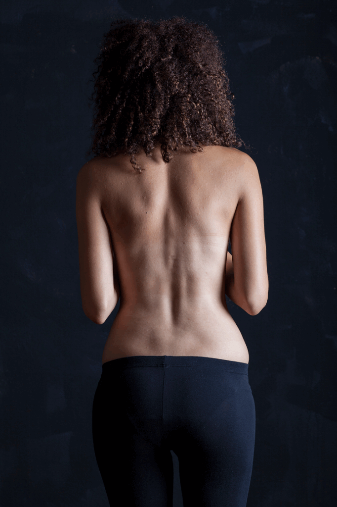 Aqualyx, fat dissolving, fat melting injections, London, North London, Finchley
