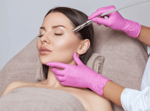 Microdermabrasion North London, London, Finchley