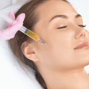 PRP treatment, vampire facial, London, North London, Finchley