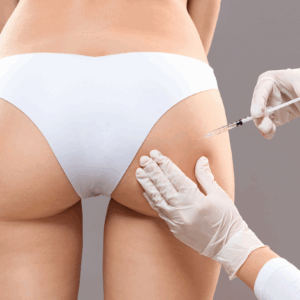 Butt fillers body fillers, London, North London, Finchley
