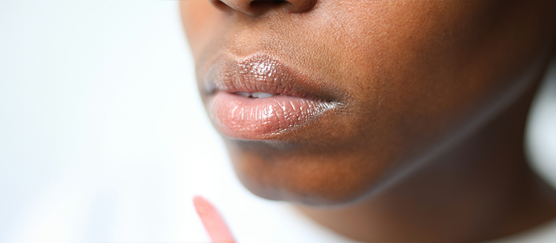 lip augmentation in London, North London