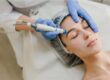 Microdermabrasion in London, North London, Finchley Cosmetic Salon