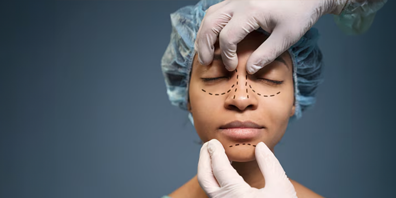 image (8) Morpheus8 in London for Face and Body